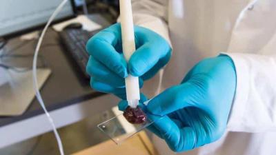 A kép illusztráció! (Forrás: nst.com)