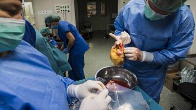 Szívkivétel műtét után becsomagolják a szívet az egyik fõvárosi kórházában. MTI/Mónus Márton