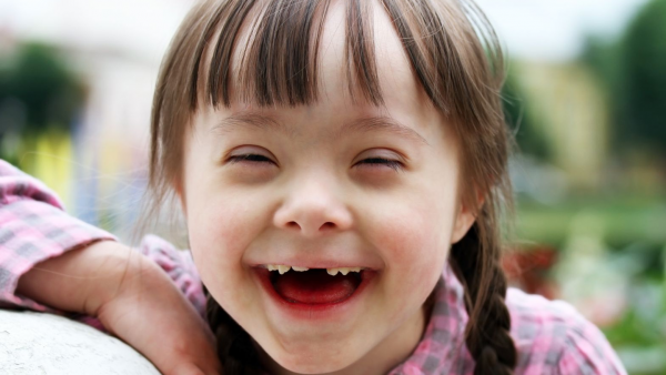 Forrás: downegyesulet.hu